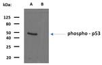 Phospho-p53 (Ser392) Antibody in Western Blot (WB)