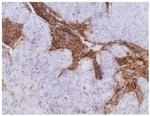 CEA Monoclonal Antibody (CB30)