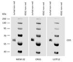 CD5 Antibody in Western Blot (WB)