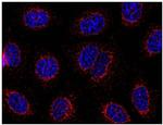 STIM1 Monoclonal Antibody (CDN3H4)