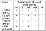Blood Group B Antigen Antibody in Agglutination (AGG)