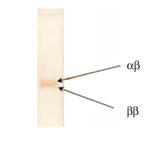 S100 Monoclonal Antibody (6G1)