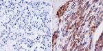 NMDAR2B Monoclonal Antibody (NR2B)