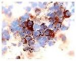 CXCR4 / CD184 Antibody in Immunohistochemistry (Paraffin) (IHC (P))