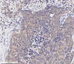 Phospho-AKT1 (Ser473) Monoclonal Antibody (104A282)