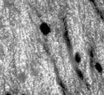 Bassoon Antibody in Immunohistochemistry (IHC)
