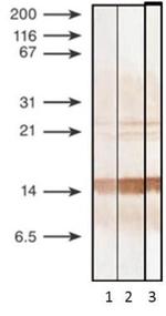 Procalcitonin Monoclonal Antibody (6F10)
