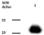 Adiponectin Monoclonal Antibody (Ne.Na)