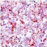 Myb Antibody in Immunohistochemistry (IHC)