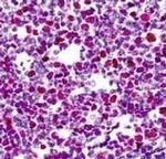 Cdc7 Antibody in Immunohistochemistry (IHC)