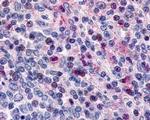 Avidin Antibody in Immunohistochemistry (IHC)