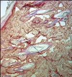 Collagen III Antibody in Immunohistochemistry (Paraffin) (IHC (P))
