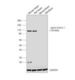 Sarcomeric alpha Actinin Antibody in Western Blot (WB)