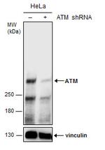 ATM Antibody in Western Blot (WB)