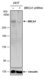 BRCA1 Antibody in Western Blot (WB)