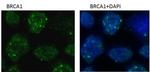BRCA1 Monoclonal Antibody (6B4)