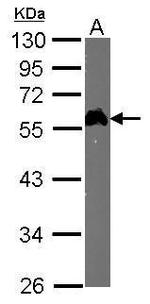 E2F1 Antibody in Western Blot (WB)