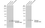Estrogen Receptor beta Antibody in Western Blot (WB)