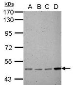 Estrogen Receptor beta Antibody in Western Blot (WB)