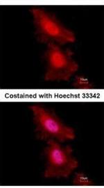 FOXO1 Antibody in Immunocytochemistry (ICC/IF)