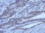 FOXO1 Antibody in Immunohistochemistry (Paraffin) (IHC (P))