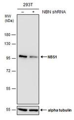 NBS1 Antibody