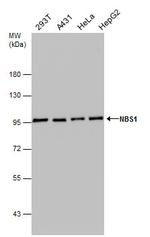 NBS1 Antibody in Western Blot (WB)
