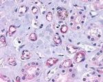 Progesterone Receptor Antibody in Immunohistochemistry (IHC)