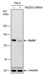 RAD50 Antibody