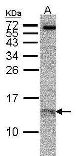 RPA14 Antibody in Western Blot (WB)