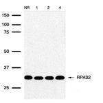 RPA2 Antibody in Western Blot (WB)
