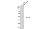 TSG101 Antibody in Western Blot (WB)