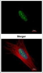Ku80 Monoclonal Antibody (9403)