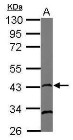 RAD51 Monoclonal Antibody (13E4)