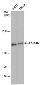 FANCD2 Monoclonal Antibody (103)