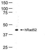 RAD52 Antibody in Western Blot (WB)