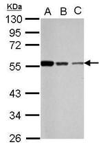 Chk1 Antibody in Western Blot (WB)
