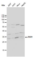 RAD1 Monoclonal Antibody (4126)