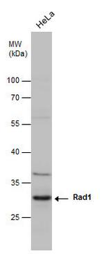 RAD1 Antibody in Western Blot (WB)
