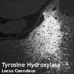 Tyrosine Hydroxylase Antibody in Immunohistochemistry (IHC)