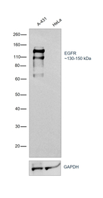 EGFR Antibody in Western Blot (WB)