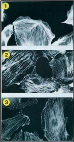 alpha Actinin 1 Antibody in Immunocytochemistry (ICC/IF)