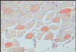 Slow Skeletal Muscle Myosin Antibody in Immunohistochemistry (Paraffin) (IHC (P))