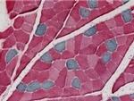 Slow Skeletal Muscle Myosin Antibody in Immunohistochemistry (IHC)