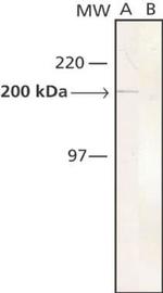 Slow Skeletal Muscle Myosin Antibody in Western Blot (WB)