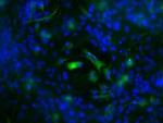 S100B Antibody in Immunocytochemistry (ICC/IF)