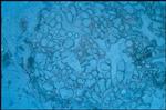 S100B Antibody in Immunohistochemistry (IHC)