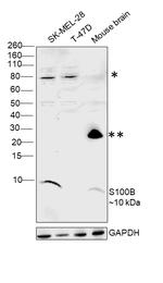 S100B Antibody in Western Blot (WB)
