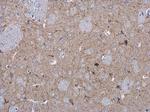 MAP2 Antibody in Immunohistochemistry (Paraffin) (IHC (P))