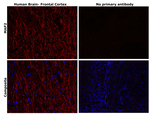 MAP2 Antibody in Immunohistochemistry (Paraffin) (IHC (P))